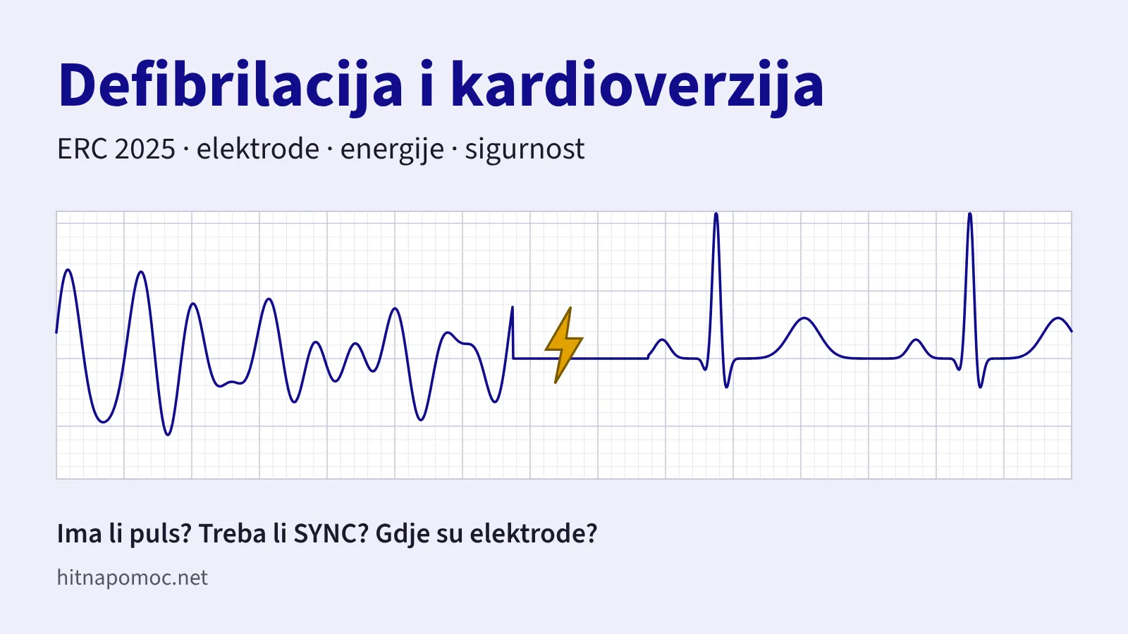 EKG traka na kojoj ventrikularnu fibrilaciju prekida šok, a zatim slijedi sinusni ritam, uz naslov Defibrilacija i kardioverzija.